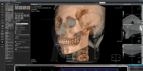 OnDemand3D Dental 2022