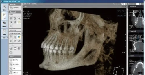 OnDemand3D Dental 2022