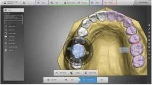 Autolign 3d Diorco 2022