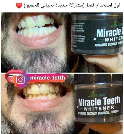 Miracle Teeth Whitener