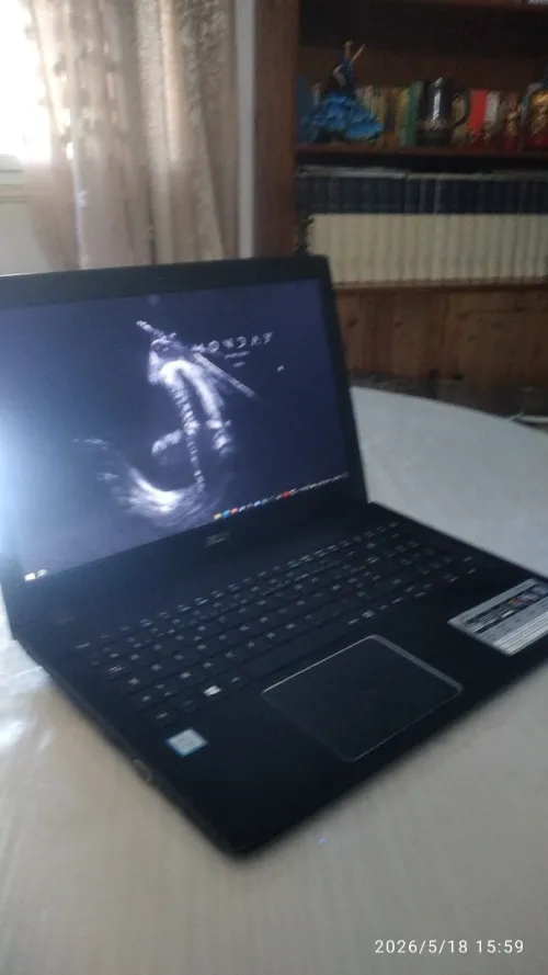 Pc portable Acer Aspire E5-575-78GT I7 7eme gen