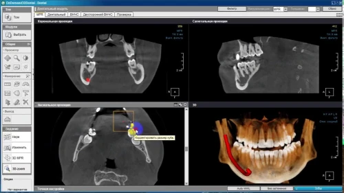 OnDemand3D Dental 2024