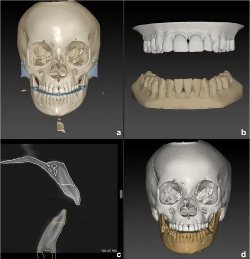 IPS CaseDesigner 2.5.7.1 (2024)