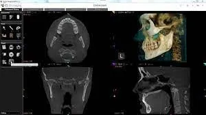 CS 3D Imaging 3.10.21