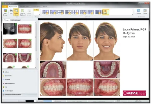 AudaxCeph Ultimate 6.6.12.4731 (2025)