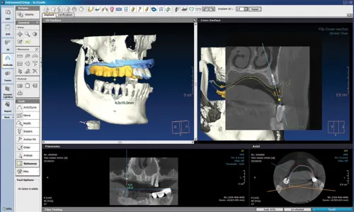 OnDemand3D Dental 2024