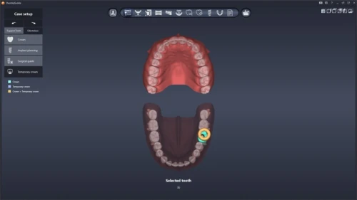 DentiqGuide 