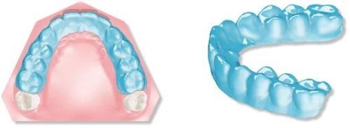 Maestro 3D Dental Studio V6