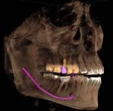 CS 3D Imaging 3.10.21