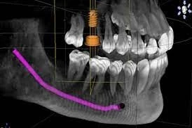 CS 3D Imaging 3.10.21