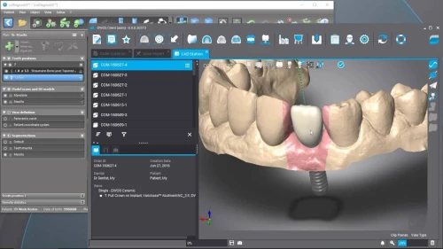 coDiagnostiX v10.9 (2025)