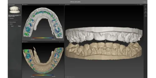 IPS CaseDesigner 2.5.7.1 (2024)