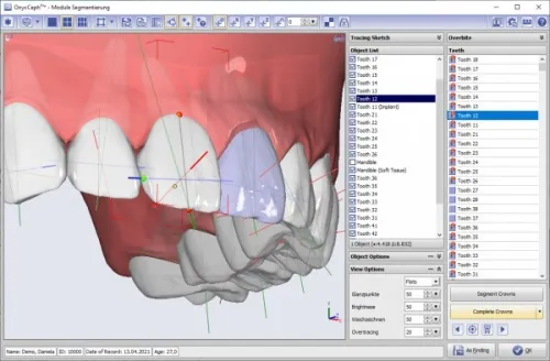 OnyxCeph 2025 (Build 3.2.233)