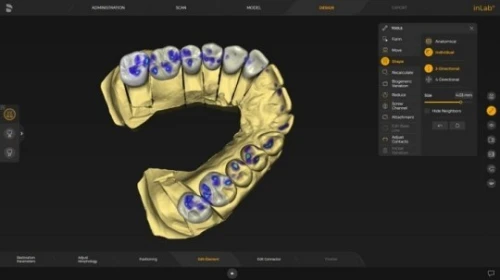 InLab CAD SW 22.1
