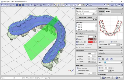 OnyxCeph 2025 (Build 3.2.233)