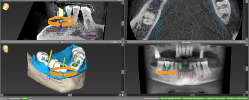 coDiagnostiX v10.9 (2025)