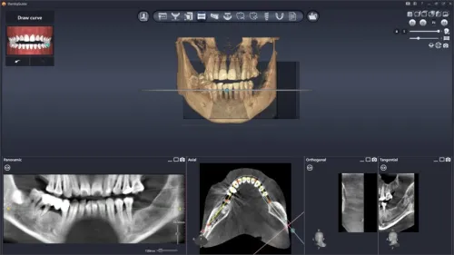 DentiqGuide 