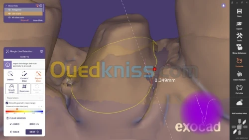 ExoCAD 3.2 Elefsina