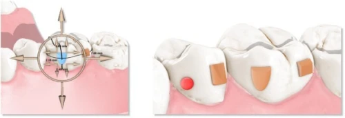 Maestro 3D Dental Studio V6