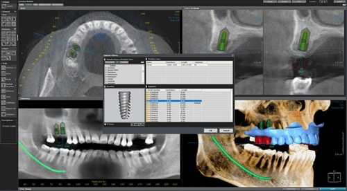 OnDemand3D Dental 2024