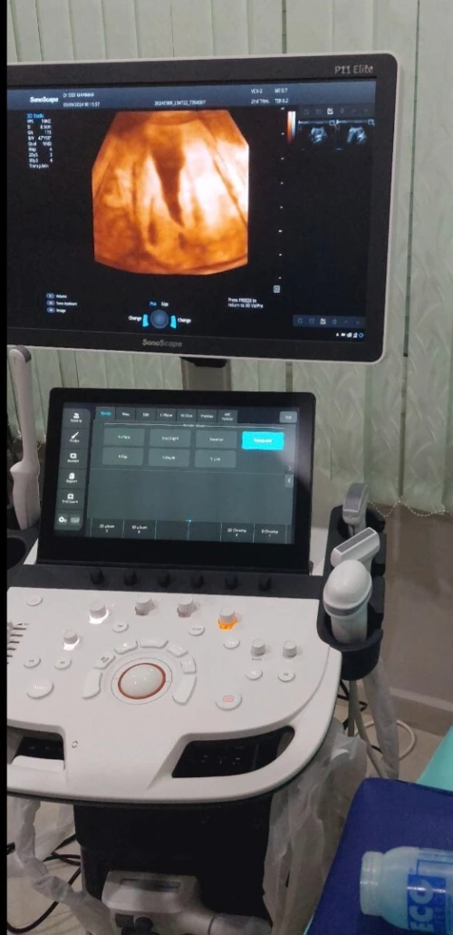 Échographe SonoScape P11 Elite