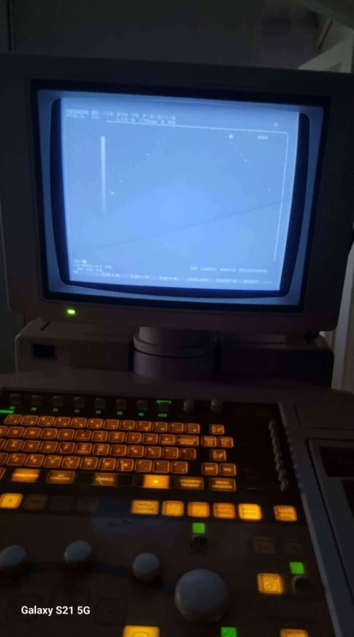 Echographe 
