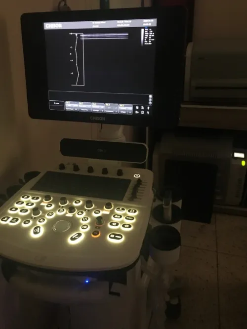 Echographe 