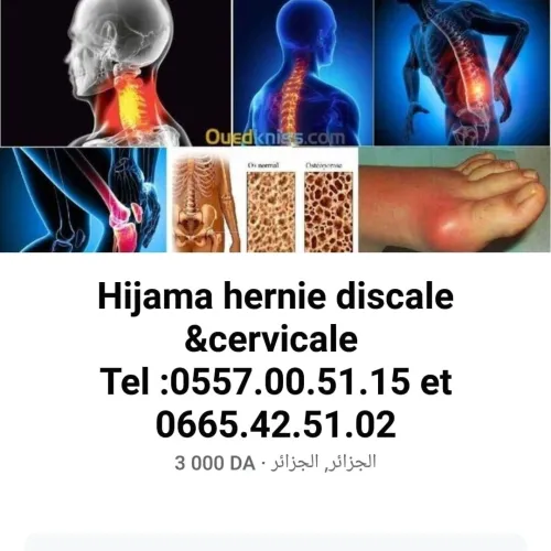 Hijama & Acupuncture Médical 