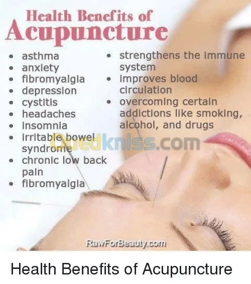 Hijama & Acupuncture Médical 