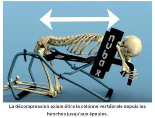  Nubax appareil de soin personnel de la colonne vertébrale, Hernie discale, sciatique... 