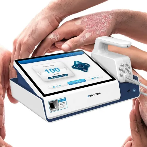 Excimer laser 308nm vitiligo