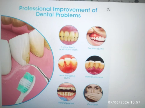 Brosse à dents électrique/Détartrage
