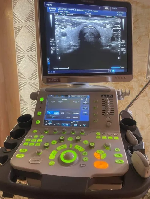 Echographe TOSHIBA APLIO 400