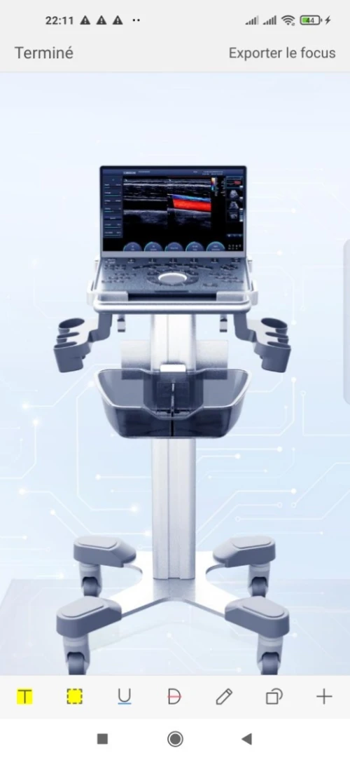 Echographe chison 