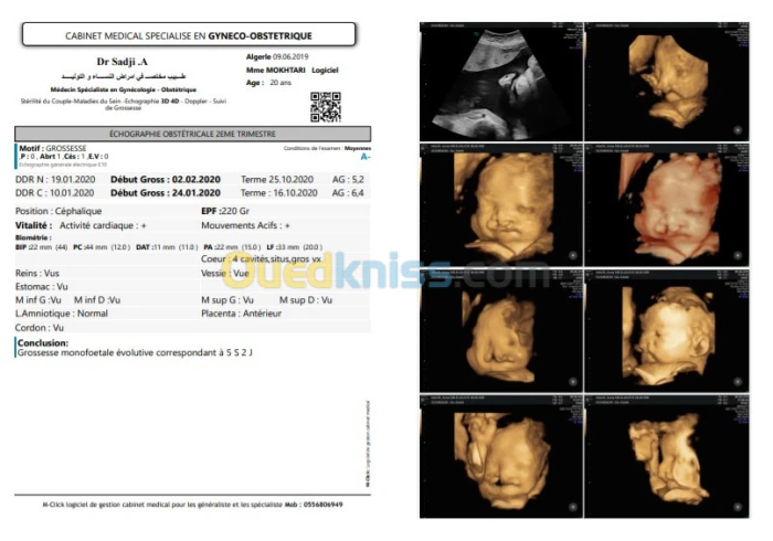 M-Click gynecologie Logiciel médical