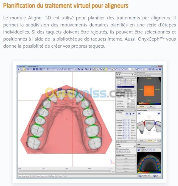 OnyxCeph 2026 Build 3.2.244(668) 21