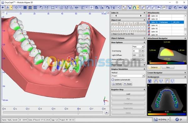 OnyxCeph 2026 Build 3.2.244(668) 3